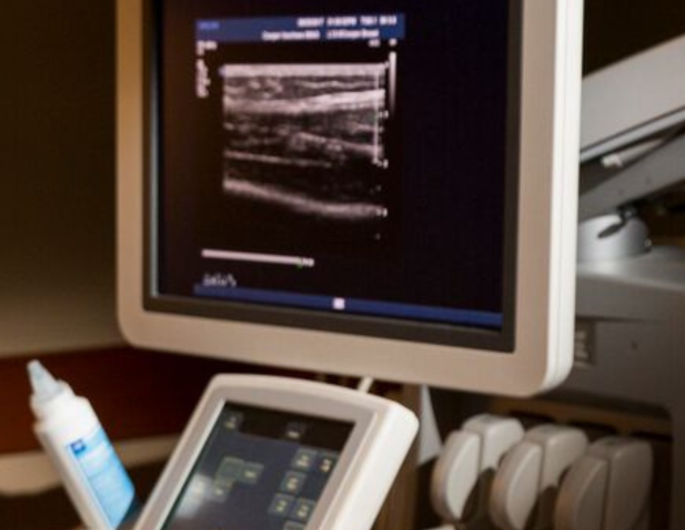 Ultrasound image on screen