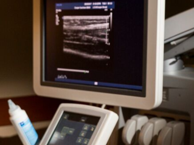 Ultrasound image on monitor