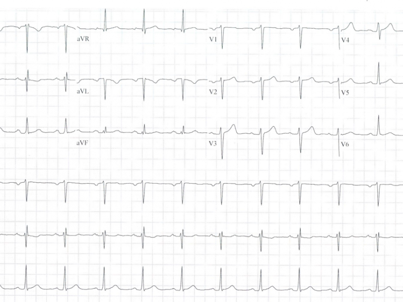 EKG Conference