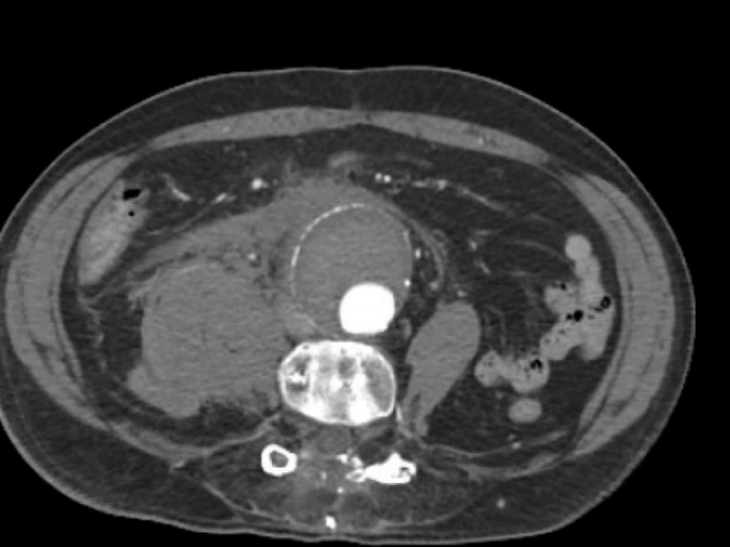 What's the Diagnosis? By Dr. Eric Chavis