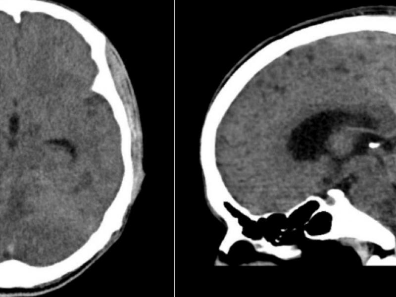 What's the diagnosis?  By Dr. Katie Nowlan