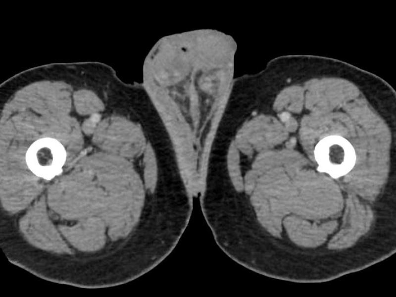 What's the Diagnosis? By Dr. Eric Chavis 