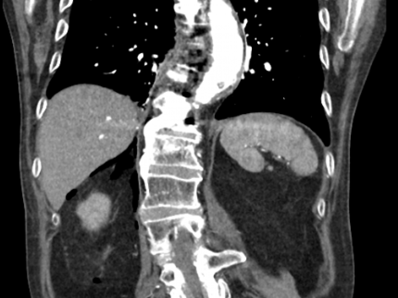 What's the Diagnosis? By Dr. Sarab Sodhi