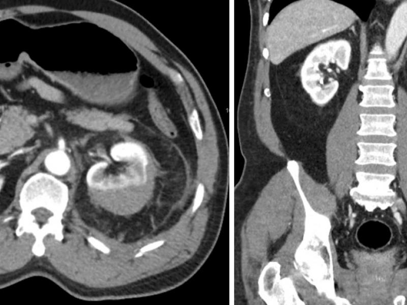 What's the diagnosis?  By Dr. Becca Fieles