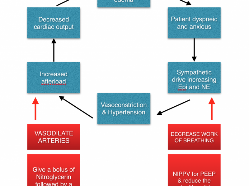 How to E(SCAPE) Intubation