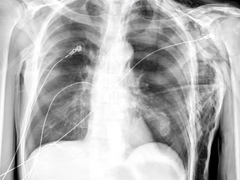 What's the diagnosis? By Dr. Loran Hatch