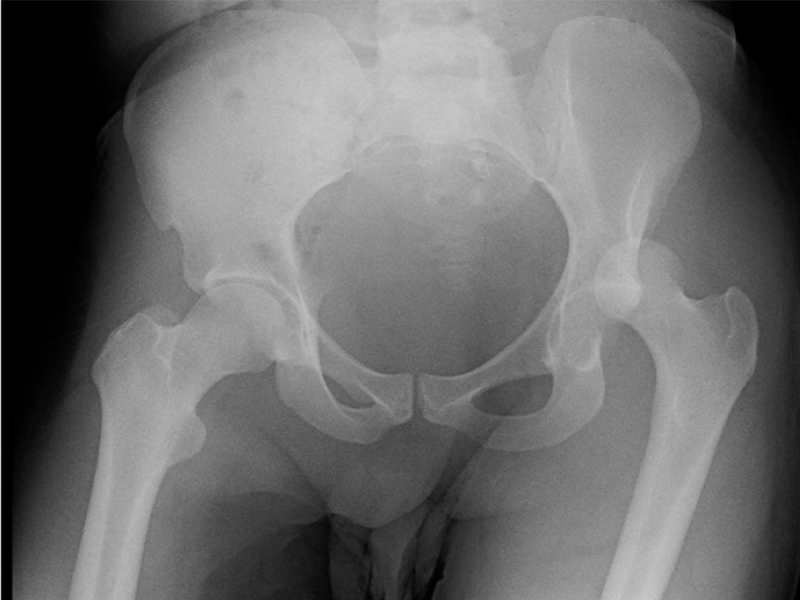 What’s the Diagnosis? By Dr. Loran Hatch