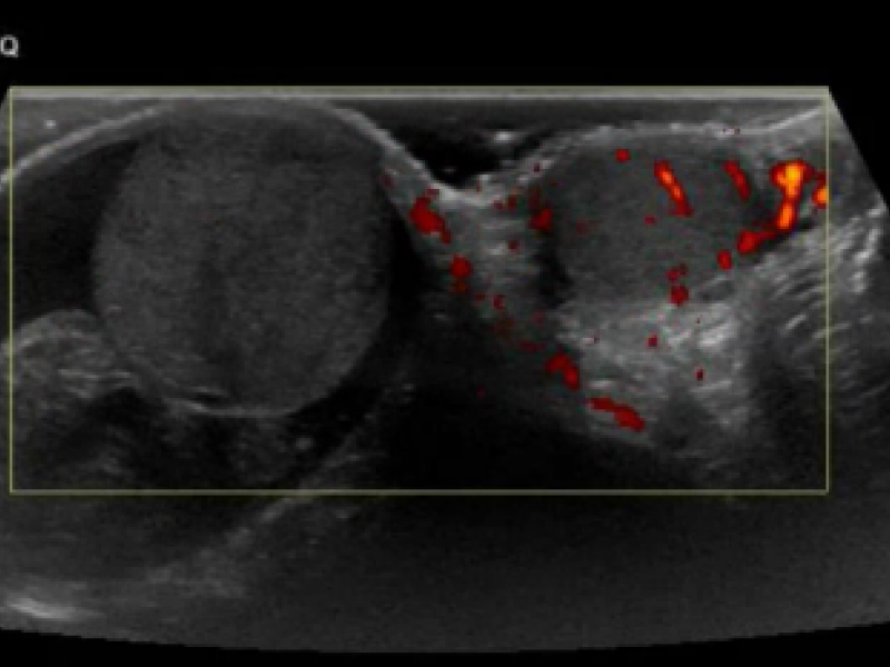 Advanced Cases and Content: Genital Pain