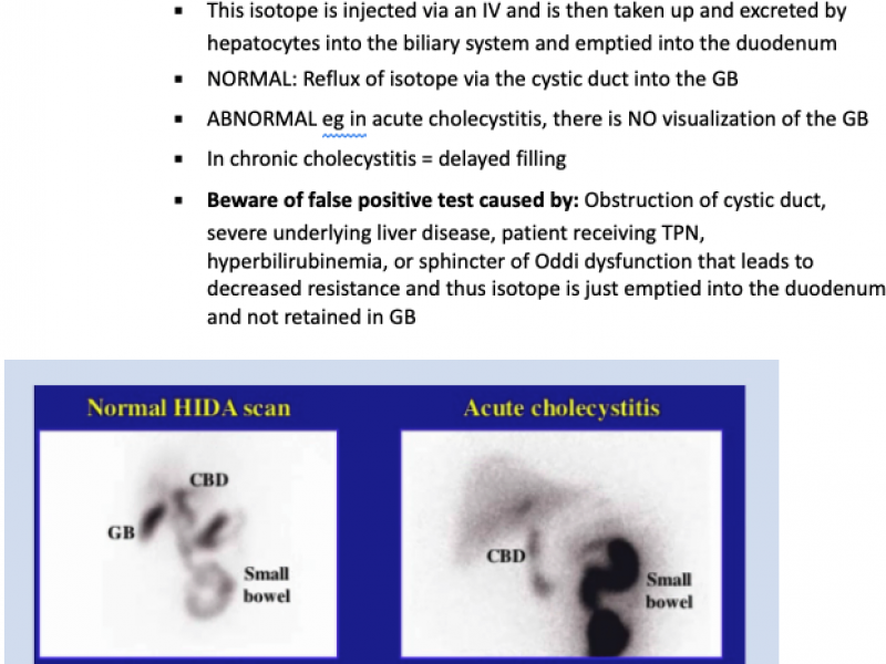 Biliary Disease