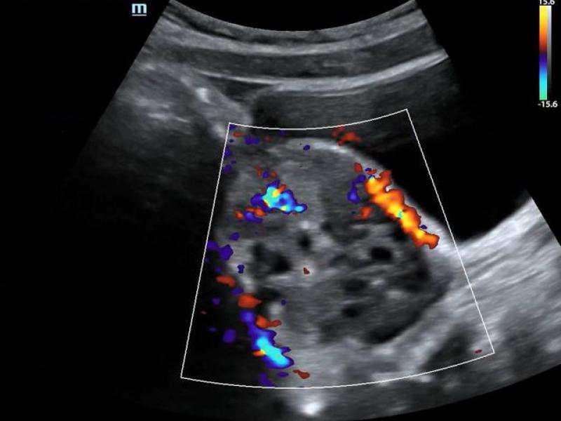 What's the Diagnosis? By Dr. Kathryn Kaminski