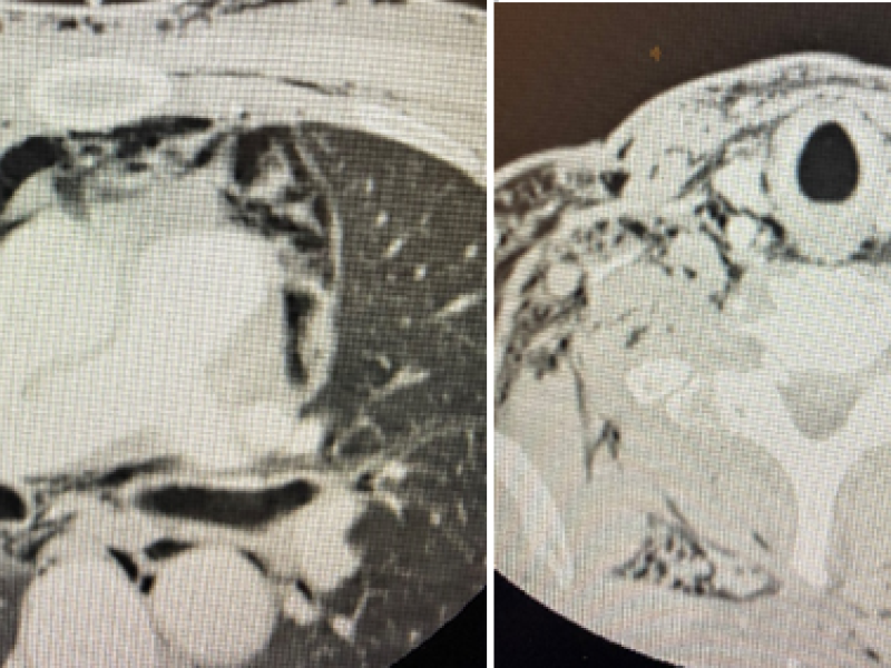 What's the Diagnosis? By Dr. Katherine Billings