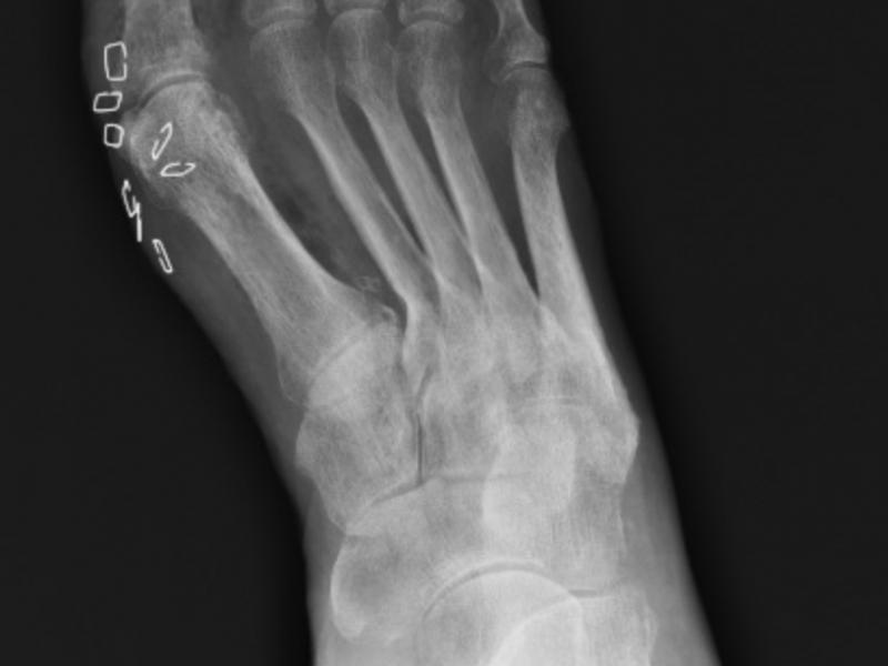 What's the diagnosis? By Dr. Patrice Baptista