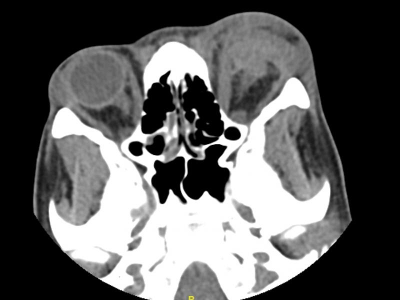 What's the diagnosis? By Dr. Angela Ugorets