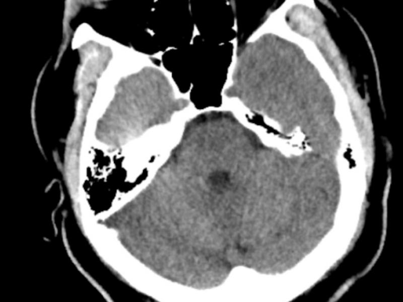 What's the diagnosis?  By Dr. Loran Hatch