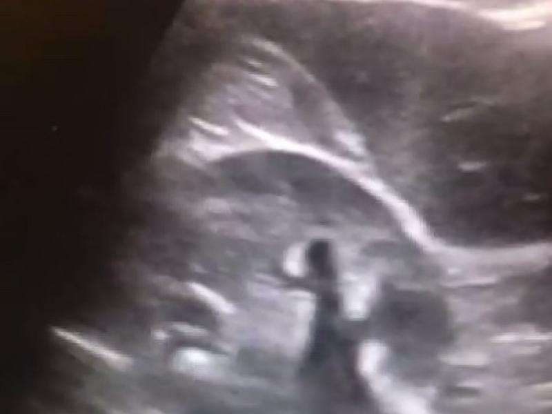 What's the diagnosis? By Dr. Michael Tom