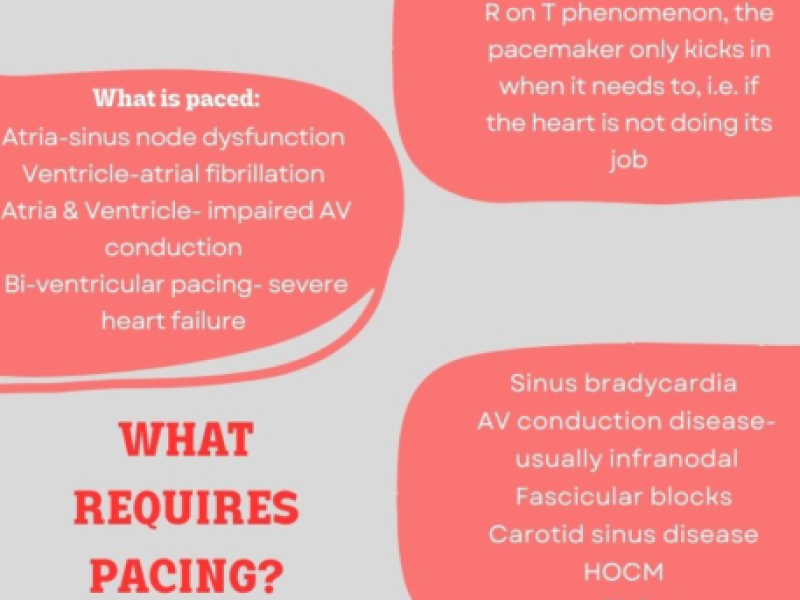 From the Archives: Pacemaker Basics by Dr. Sandhya Ashokkumar