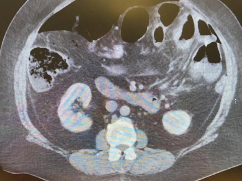 What's the diagnosis? By Dr. Charlie Ingram
