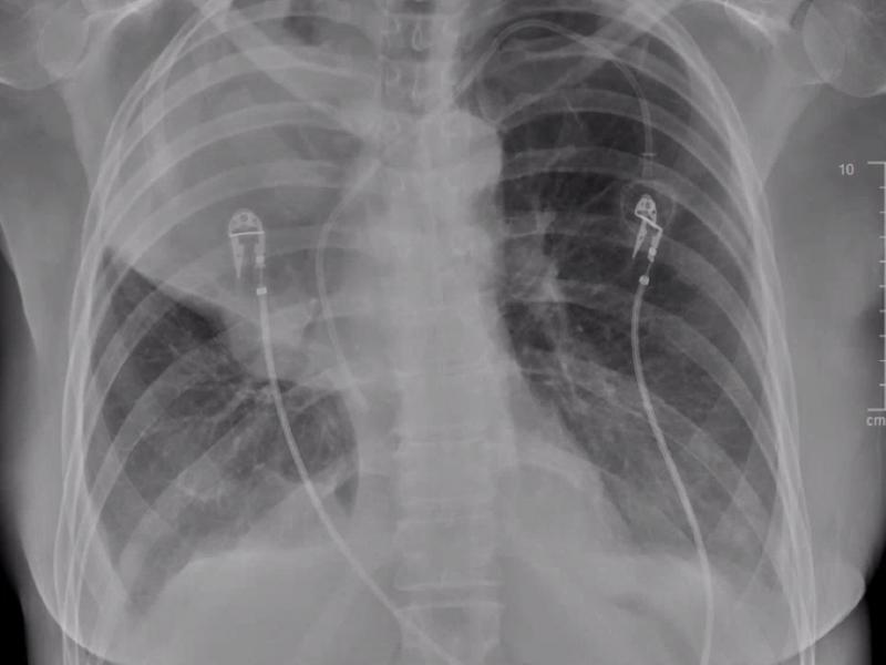 What's the diagnosis? By Dr. Erica Schramm