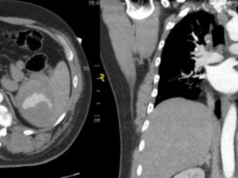 What's the Diagnosis?  By Dr. Abby Renko